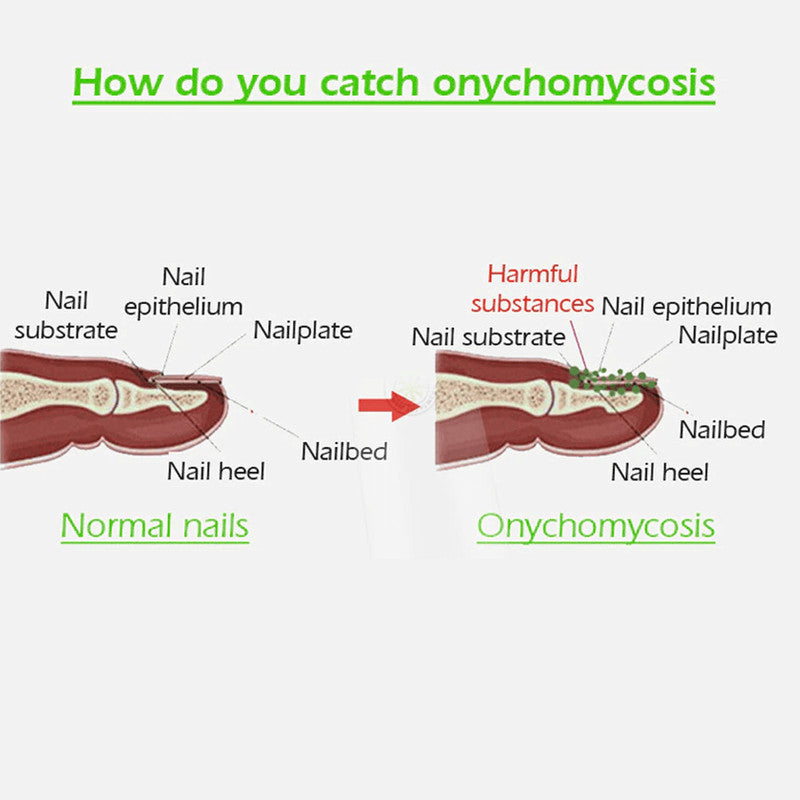 Nail Addict Nail 7 Days Treatment Gel