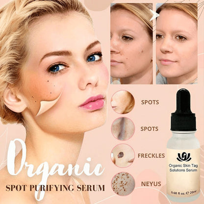 Organic Skin Spot Purifying Serum