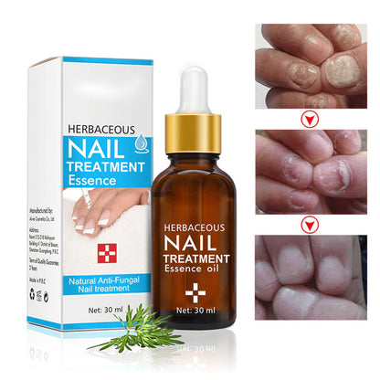 Herbaceous Nail Treatment Essence – Natural Nail Repair Serum | Ideal Beauty Gift