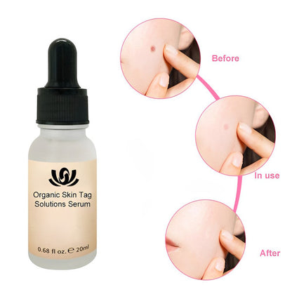 Organic Skin Spot Solutions Serum