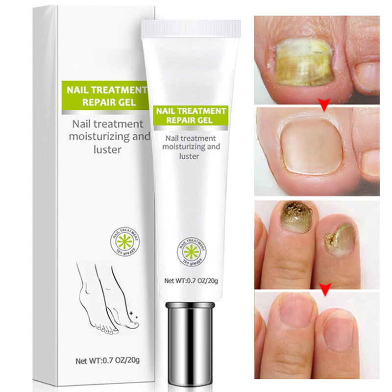 Nail Addict Nail 7 Days Treatment Gel