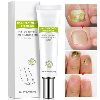 Nail Addict Nail 7 Days Treatment Gel